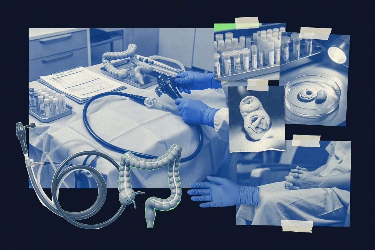 Colorectal Cancer Statistics