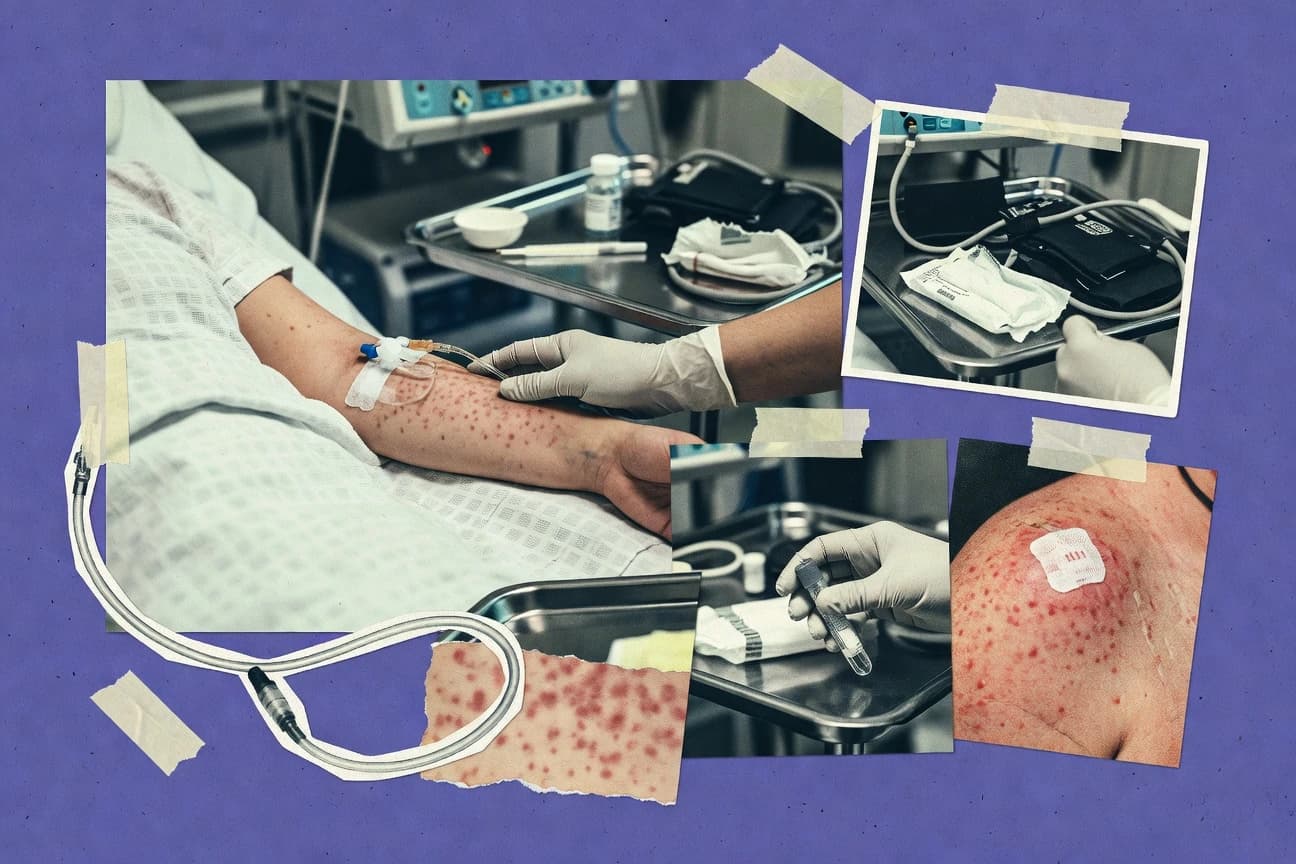 Toxic Shock Syndrome Statistics