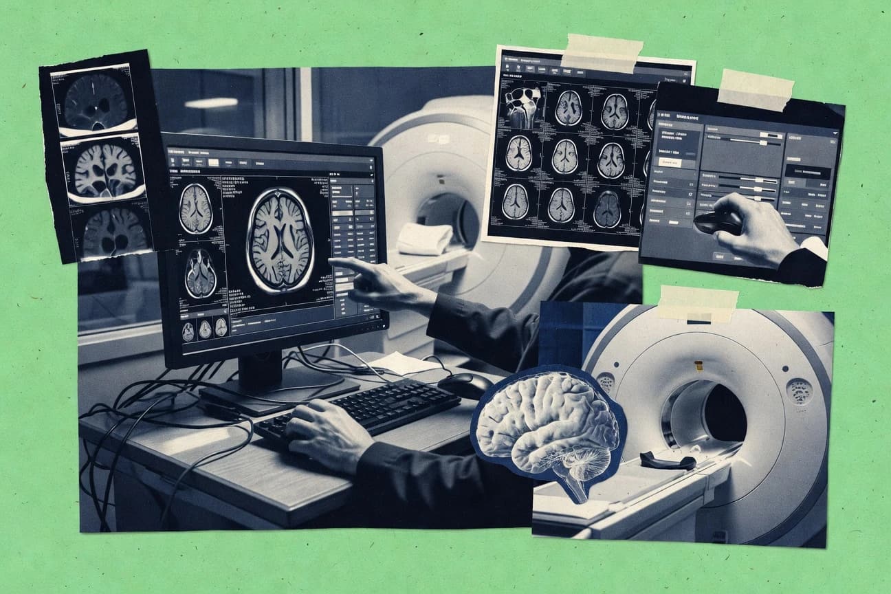 Top 10 Best Mri Viewing Software of 2026