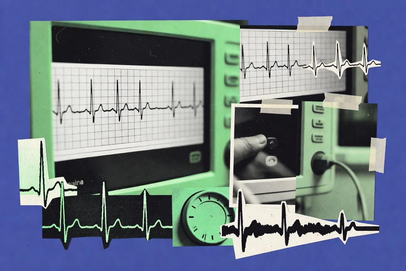Stroke Statistics