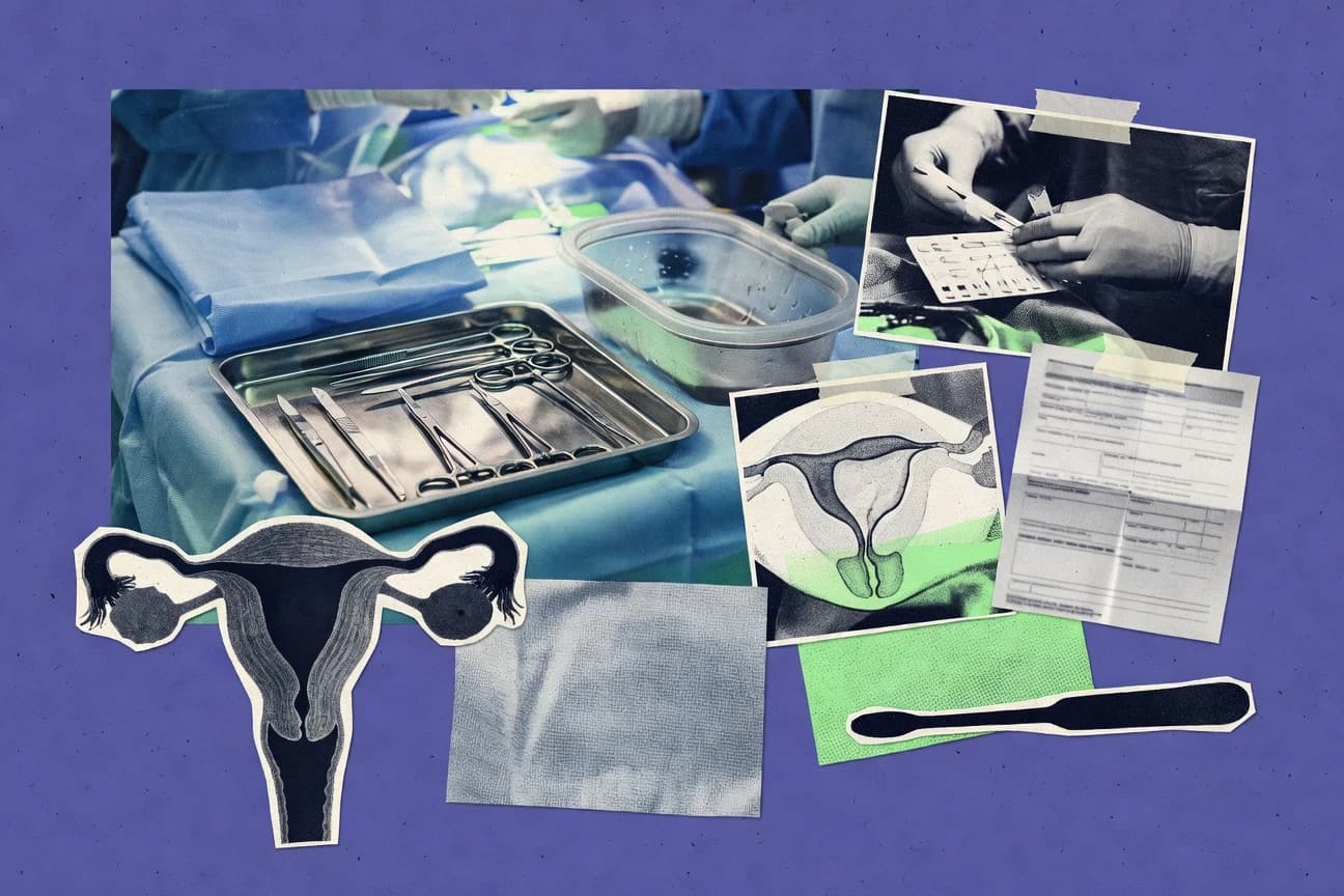 Hysterectomy Statistics