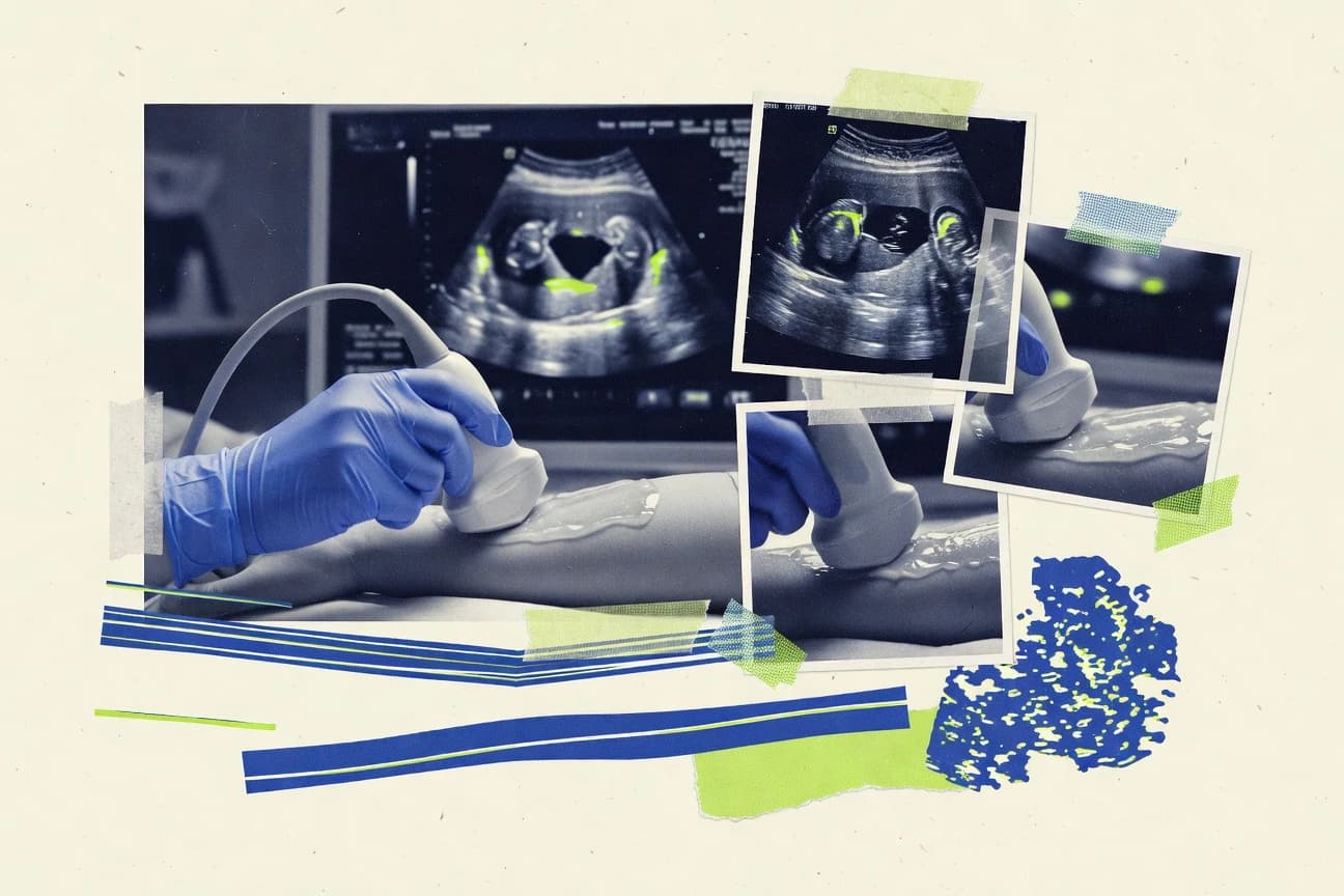 Ultrasound Statistics