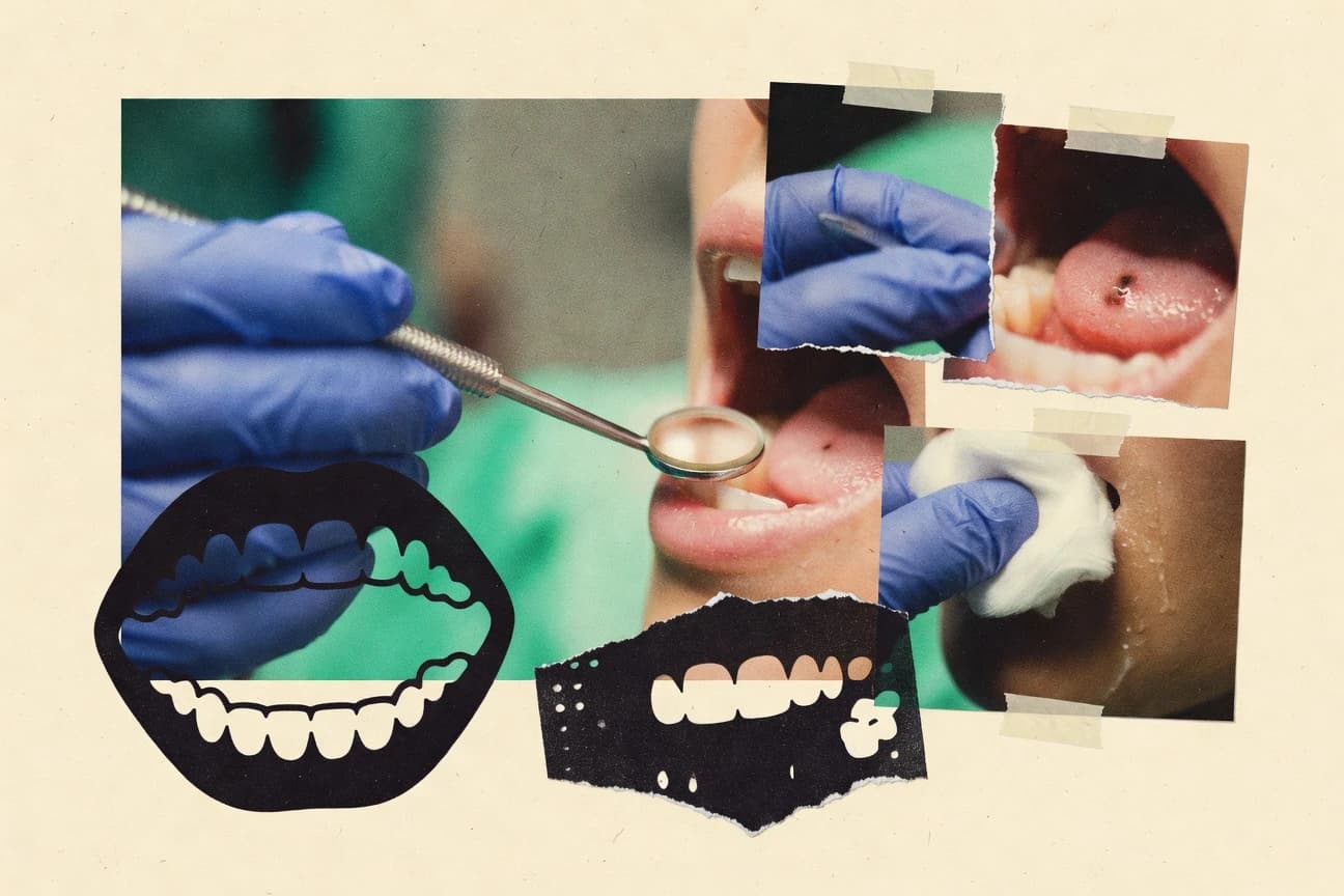 Mouth Cancer Statistics