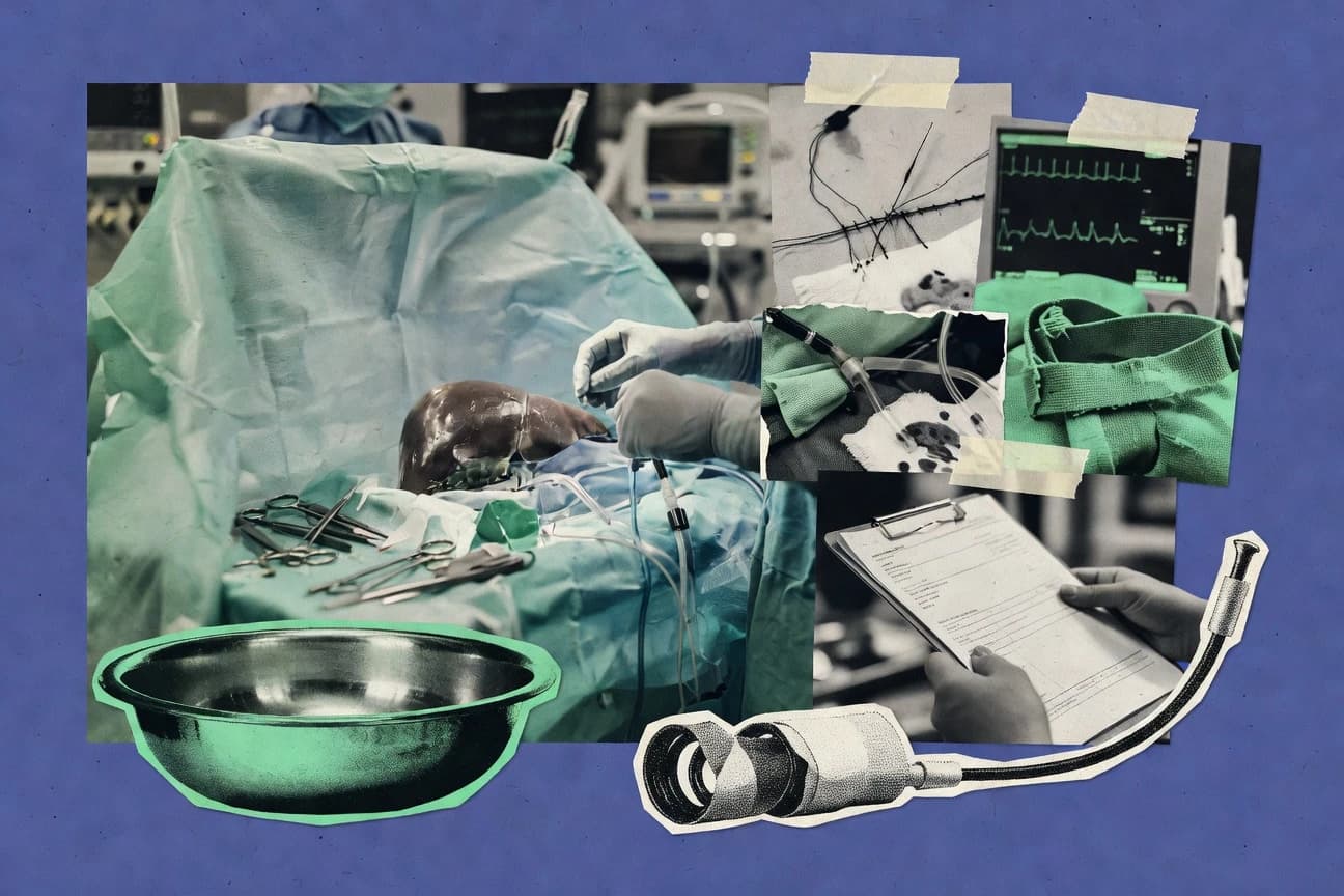 Liver Transplant Survival Statistics