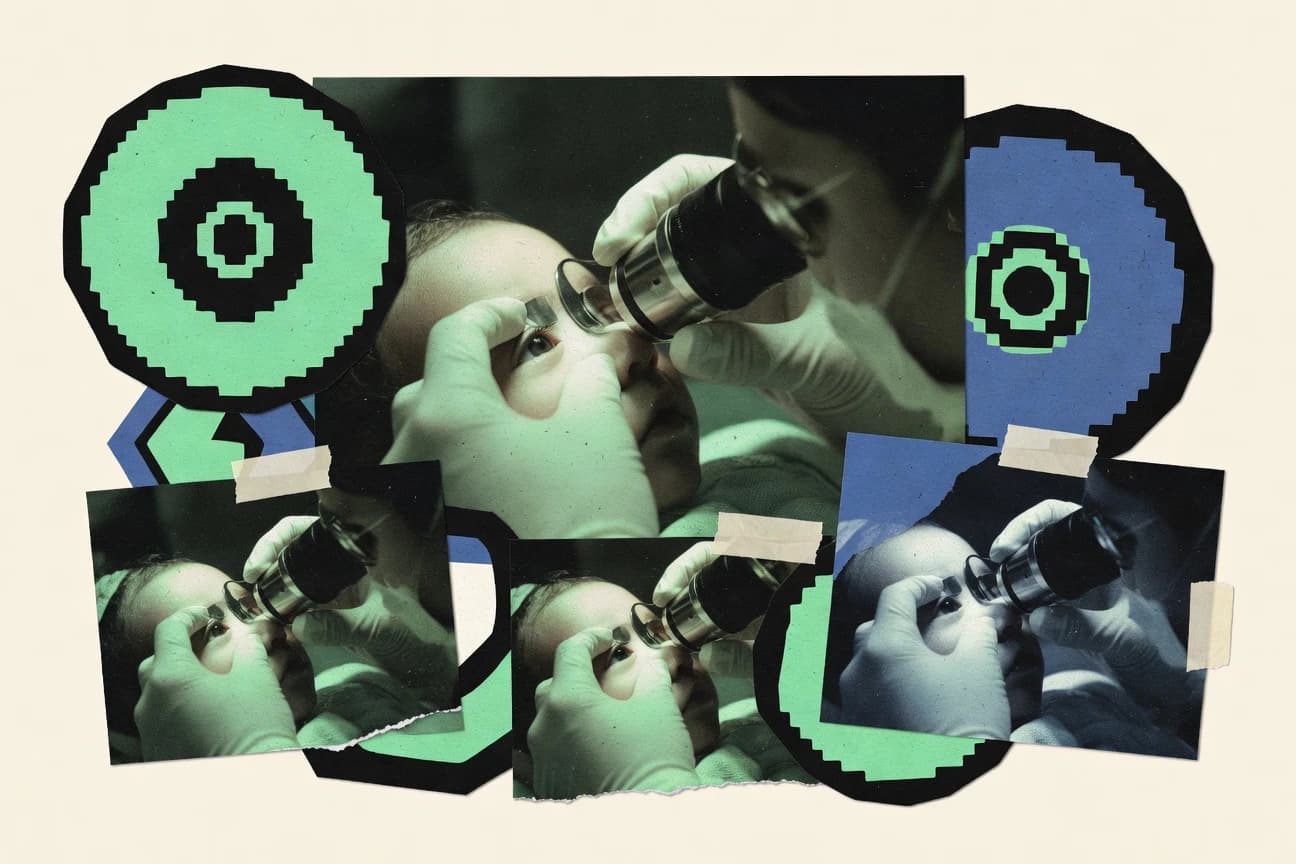 Retinoblastoma Statistics