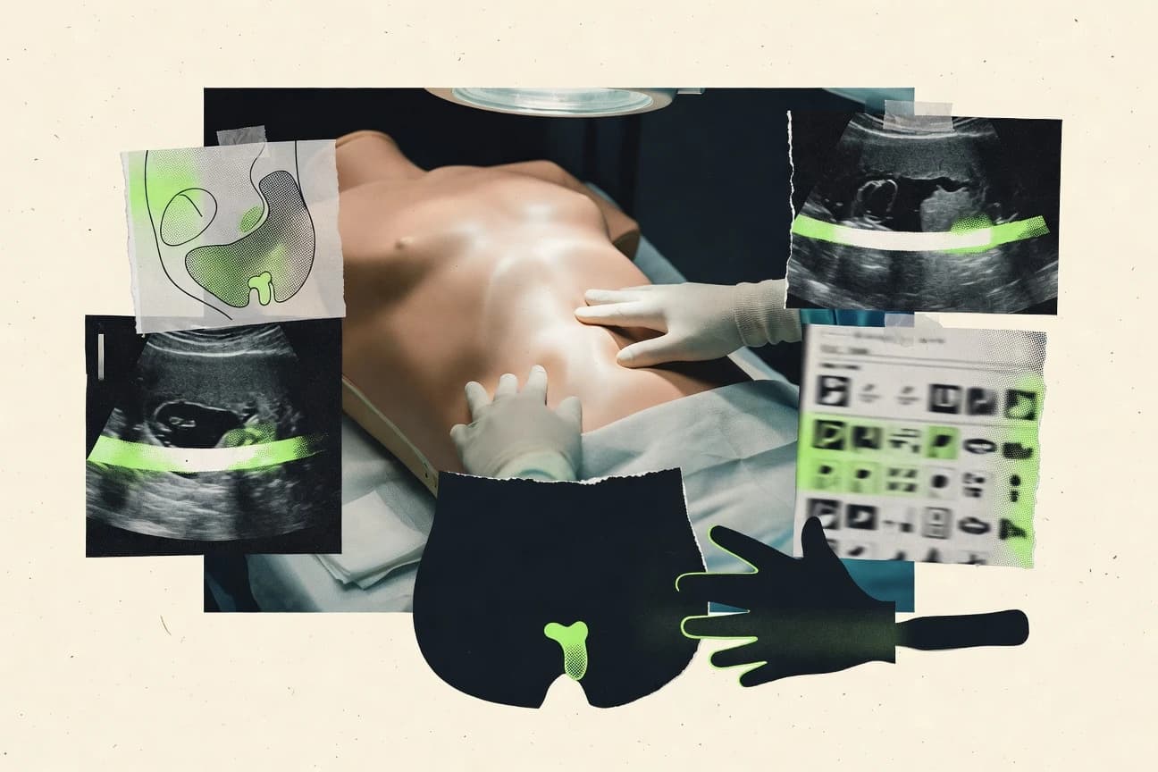 Appendicitis Statistics