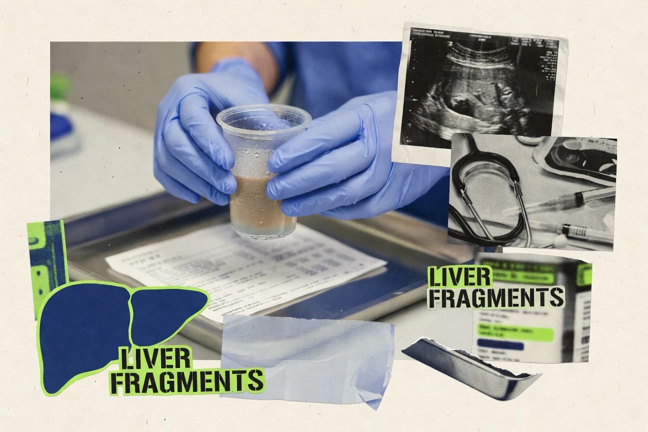 Liver Disease Statistics