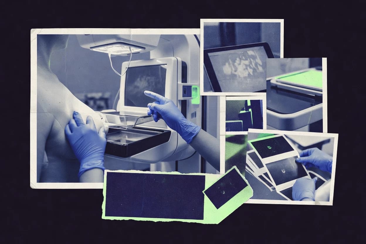 Top 10 Best Mammography Reporting Software of 2026